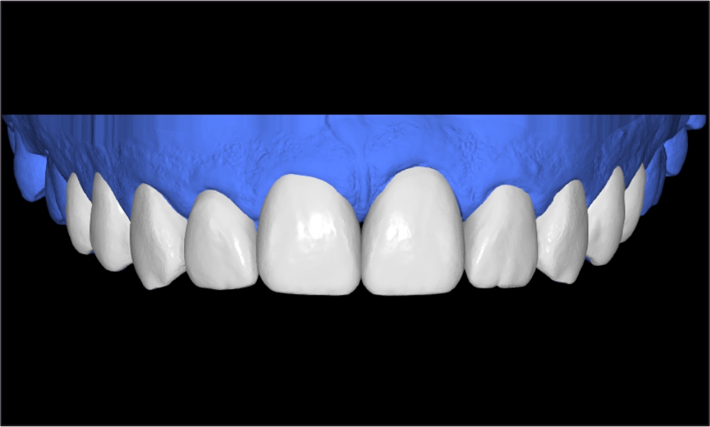 produt Image