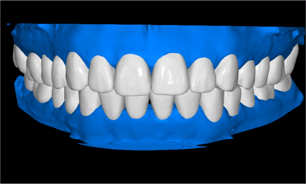 produt Image